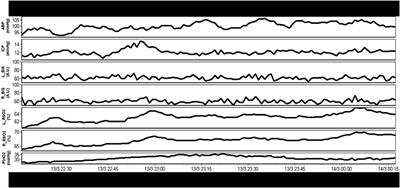 Integrative Neuroinformatics for Precision Prognostication and Personalized Therapeutics in Moderate and Severe Traumatic Brain Injury